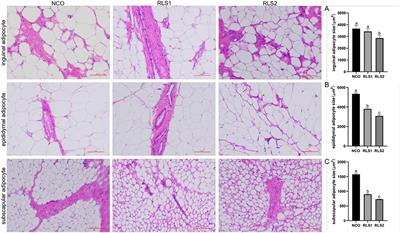Rhamnolipids Regulate Lipid Metabolism, Immune Response, and Gut Microbiota in Rats